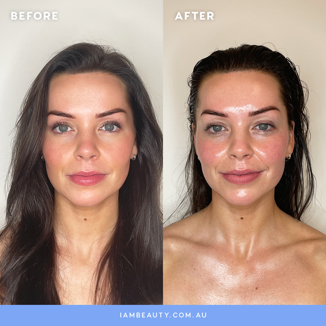 Lymphatic BuccalMassage Before and After photos